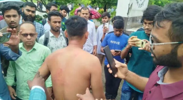 নোবিপ্রবি ছাত্রদলের দুই গ্রুপের সংঘর্ষ, সাংবাদিকসহ আহত ৯